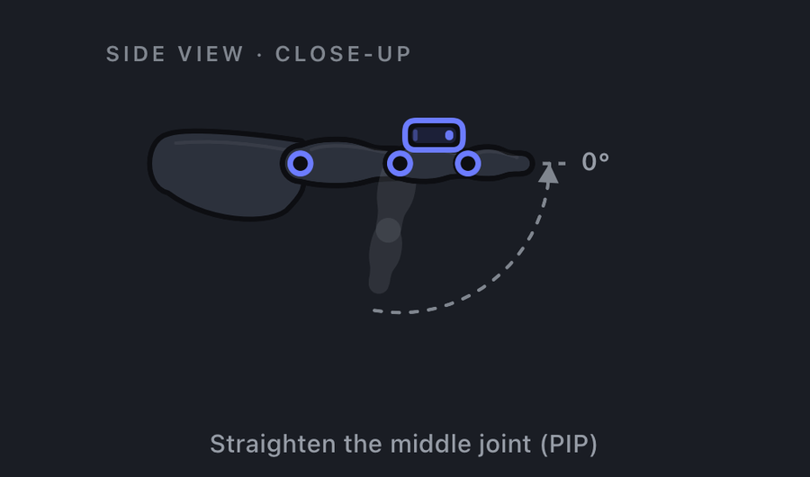 Finger PIP extension measured with a smartphone goniometer app: the finger straightening, reading 0 degrees at full extension.
