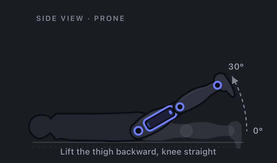 Hip extension measurement: patient prone, iPhone along the thigh, the leg lifting backward off the table with the knee straight, 0 to 30 degrees.
