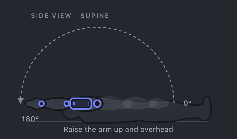 Shoulder flexion measurement: patient supine, iPhone along the upper arm, showing the 0 to 180 degree arc as the arm raises overhead.