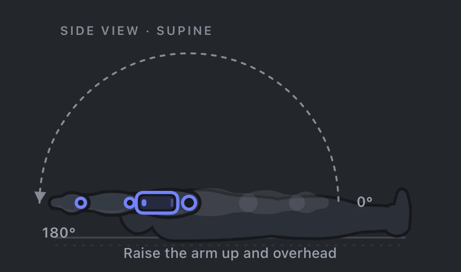 Shoulder flexion measurement: patient supine, iPhone along the upper arm, showing the 0 to 180 degree arc as the arm raises overhead.