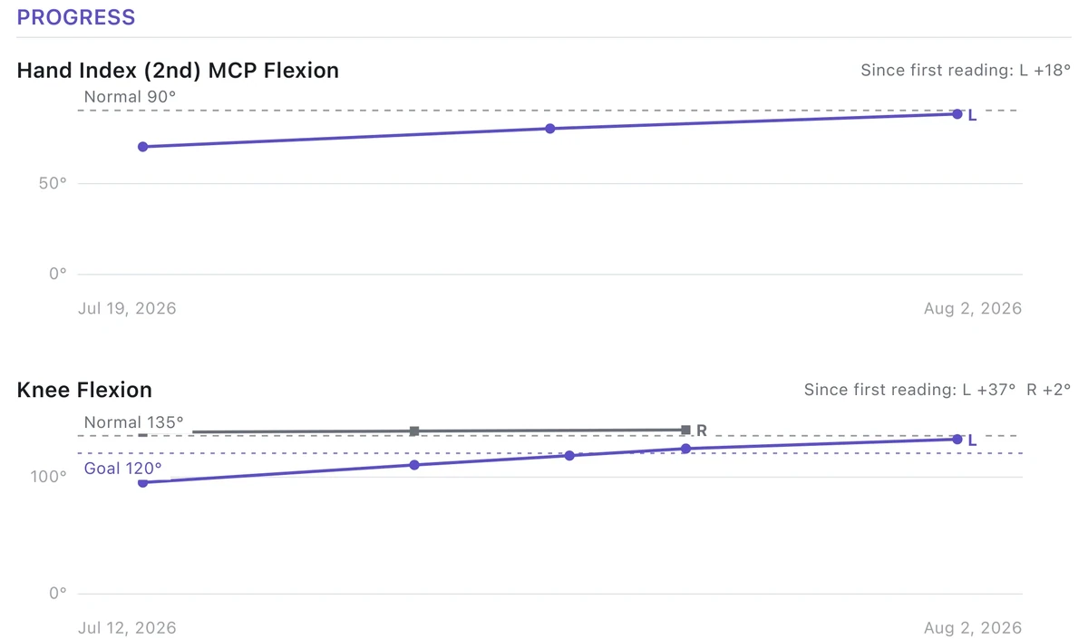 The progress section of a Goniometer Pro report: trend charts for finger MCP flexion and knee flexion plotted across visits against AAOS normal values, with a 120-degree goal target line on the knee chart and gains since the first reading